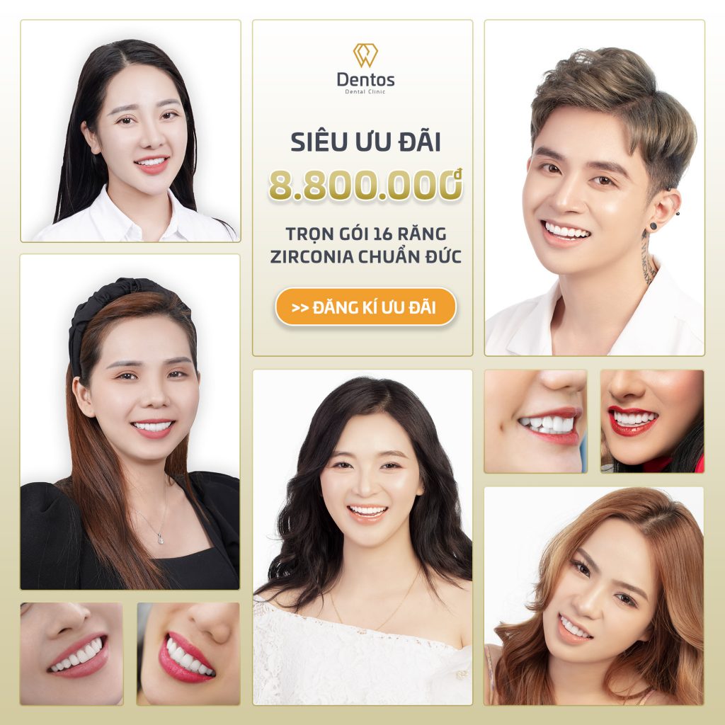 Công nghệ thiết kế nụ cười DSD chuẩn tỷ lệ vàng, hợp nhân tướng tại Nha khoa Thẩm mỹ Dentos